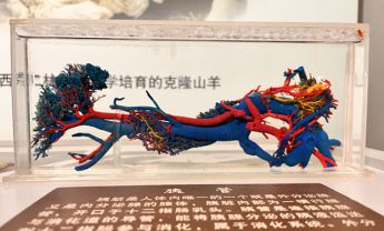 胰管
